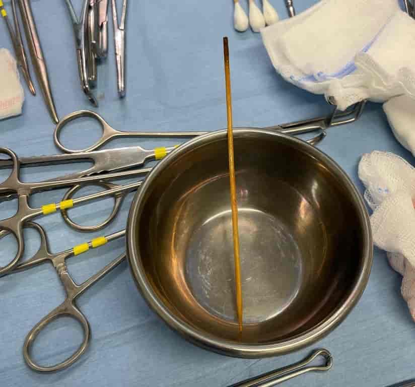 Dog's Life Was In The Balance Before Hertfordshire Vets Remove Kebab Skewer