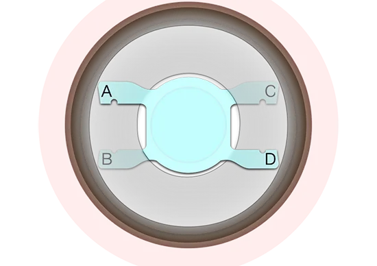 Penrith Eye Vets Report Sight-saving Success In Novel Cataract Surgery Procedure For Dogs