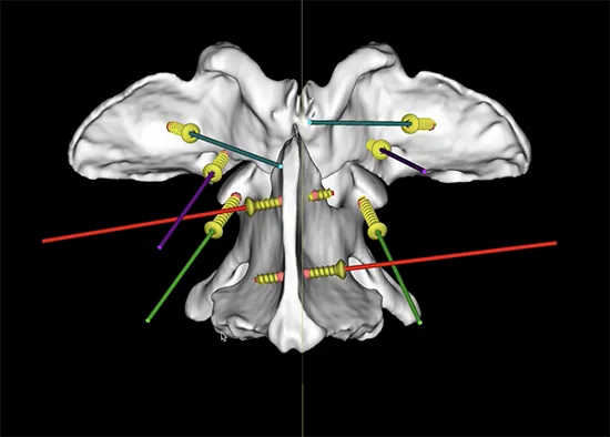 Pioneering Approach To Spinal Malformations In Dogs A Success For NDSR Specialist