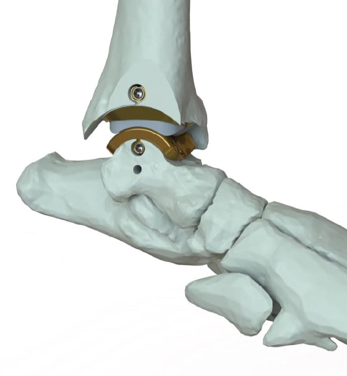 ROTTWEILER ‘OAKEY DOKEY’ AGAIN AFTER PIONEERING ANKLE SURGERY AT WEAR