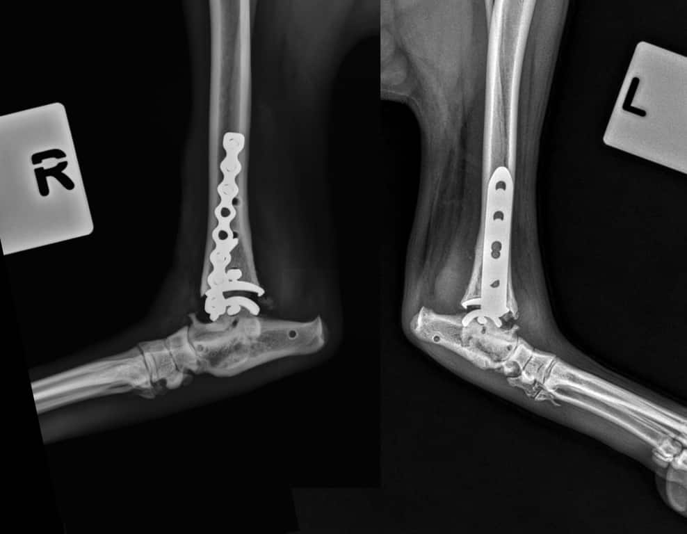 World First Double Ankle Op Completed At Wear Referrals